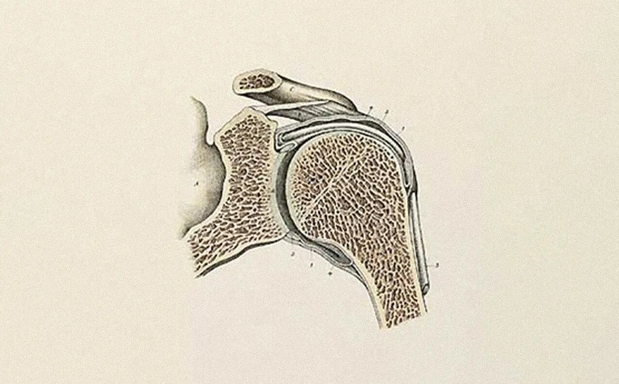 Anatomical illustration of a degenerating joint
